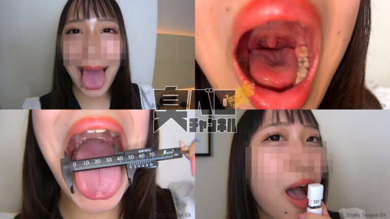 【幅広厚舌を観察&計測&舌ブラシ 沙良ちゃん】